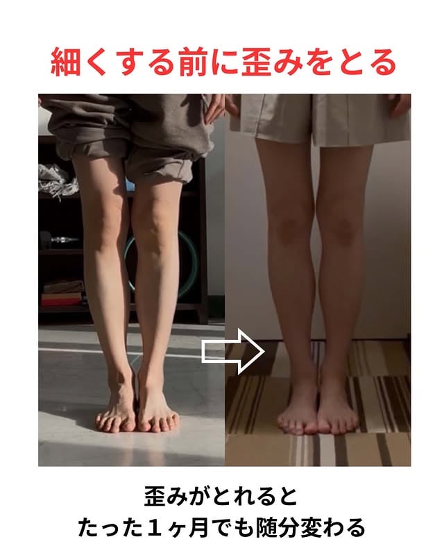 ▷脚の歪みをとる脚痩せしたい！と思った時にまず細くしたいと思いがちですが、、、骨格ボディメイクの考えでは、細くする前に歪みをとっていきます。歪みポイント足首（踵と距骨のずれ）の歪み膝（脛骨と腓骨のずれ）の歪み骨格の歪みを整えてあげると、普段の無意識動作が変わります。普段、無意識にする動きが変わってきたら、歪みが整ってきたサインですね。研究会で行った4月、5月のテクニックを使ったよ。#骨格ボディメイク#脚の歪み#脚痩せ#研究会 by @mona.risa.mm