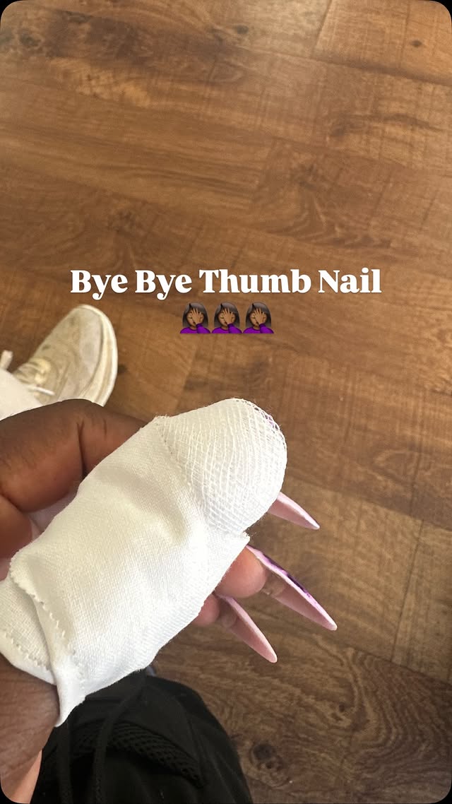 Welp there’s never a dull moment in my life, that’s for sure. My thumb nail is now completely gone and it’s time to regrow it. #fml #nailsnailsnails # by @christajanine