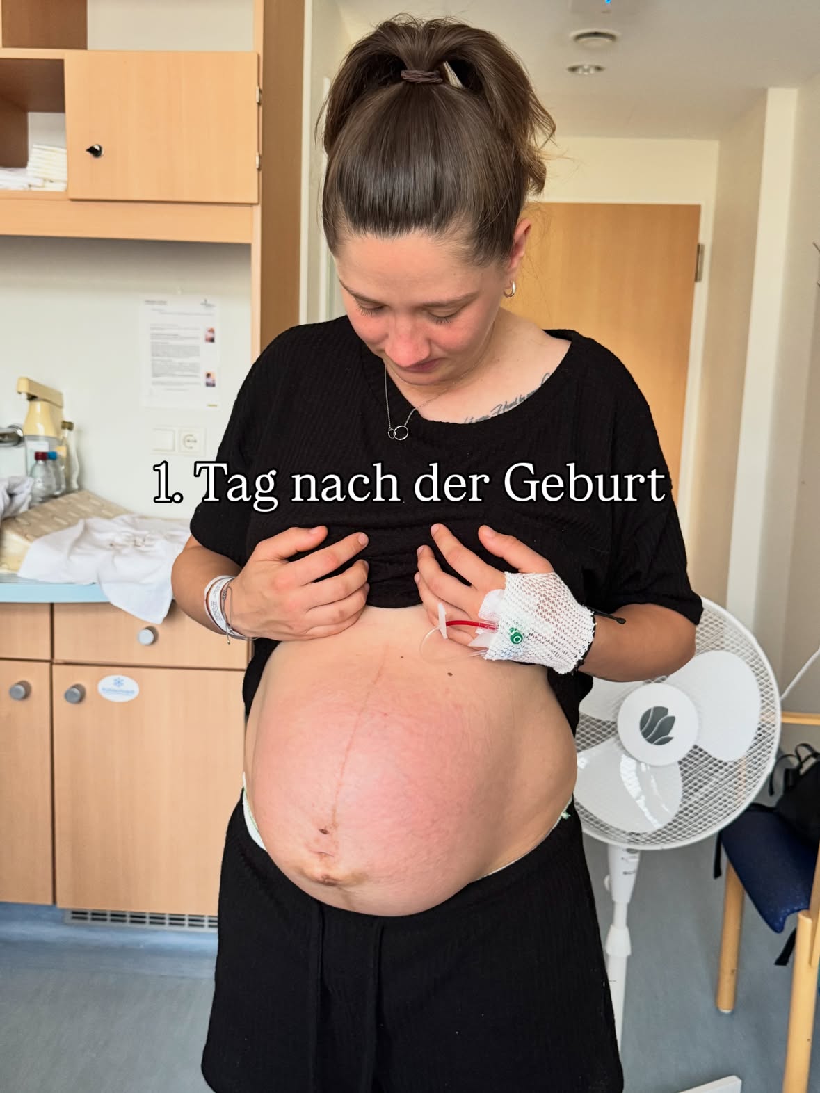 Tag für Tag nach der Geburt 🤍

Wenn ich ehrlich bin, dachte ich immer: Sobald das Baby geboren ist, verschwindet auch der Bauch direkt wieder. Aber so war es überhaupt nicht. 🙂‍↔️🙈
An den ersten beiden Tagen nach der Geburt sah ich immer noch schwanger aus, als hätte ich mein Baby noch im Bauch.

Mit jedem weiteren Tag hat sich mein Bauch Stück für Stück zurückgebildet. Es war spannend zu sehen, wie sich mein Körper täglich verändert hat. In den ersten sieben Tagen nach der Geburt habe ich ungefähr 10 Kilo verloren – natürlich durch das Baby, die Plazenta, das Fruchtwasser und wahrscheinlich auch durch viele Wassereinlagerungen.

Unsere Hebamme war jeden Tag bei uns, hat nach mir und dem Kleinen geschaut und die Rückbildung kontrolliert. Mittlerweile hat sich meine Gebärmutter wieder komplett zurückgebildet, was einfach zeigt, was für eine unglaubliche Leistung unser Körper nach einer Schwangerschaft vollbringt.🤎

Jeder Körper ist anders und jede Rückbildung verläuft individuell – aber ich wollte euch zeigen, wie es bei mir in den ersten Tagen nach der Geburt aussah. ✨
#geburt #baby #schwanger #bauch #accouple