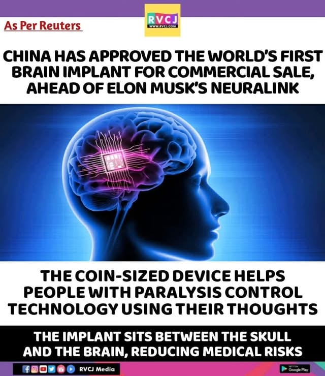 China has approved the world's first brain implant for commercial sale..#rvcjinsta