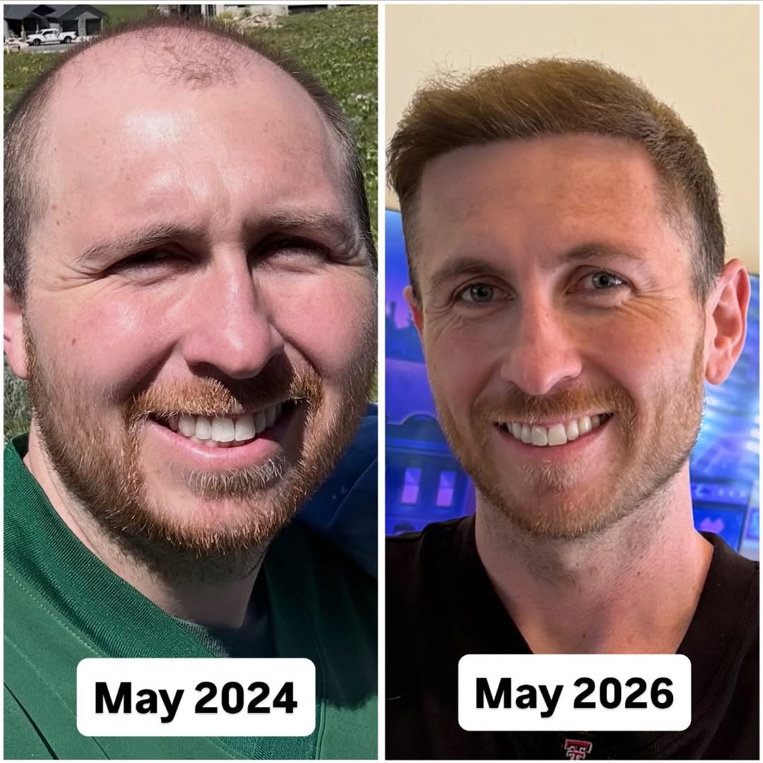 May 2024 Vs May 2026 #transformation