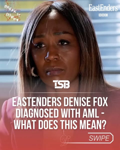 #EastEnders’ Denise Fox has been diagnosed with Acute Myeloid Leukaemia (AML) — a fast-growing blood cancer that affects thousands of people each year. 

Research shows Black patients can face poorer outcomes and greater barriers to treatment, making awareness and representation more important than ever. 

[CC: 📹 @bbceastenders] 

#TSB #TSBSpotlight