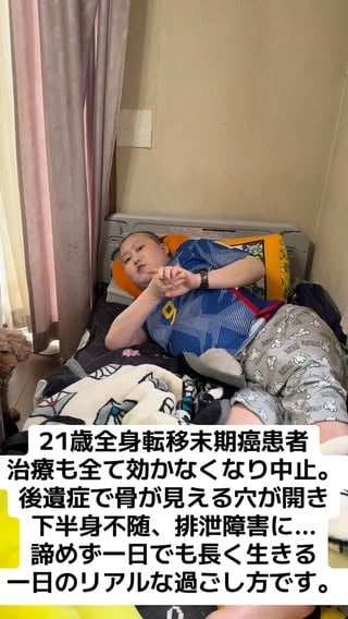【大切なお話】命が尽きるかもしれません…肺転移ステージⅣの進行&悪化が酷く、治療も全て中止になり、生存も絶望的…下半身不随、排泄障害にもなり、身体には骨が見える大きな穴が開きました。ほぼ寝たきりで激痛でも諦めず一日でも長く生きる‼️良ければここから奇跡を起こして生きる事を信じて応援宜しくお願い致します🥹🙇#骨肉腫 #05 #おすすめ #いいね #ありがとう