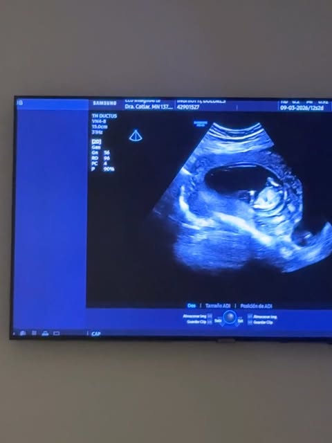 Nuestro equipo suma una nueva integrante💗

Estamos felices, agradecidos y llenos de amor por esta nueva etapa que comienza.

Te esperamos con todo el amor del mundo✨👶